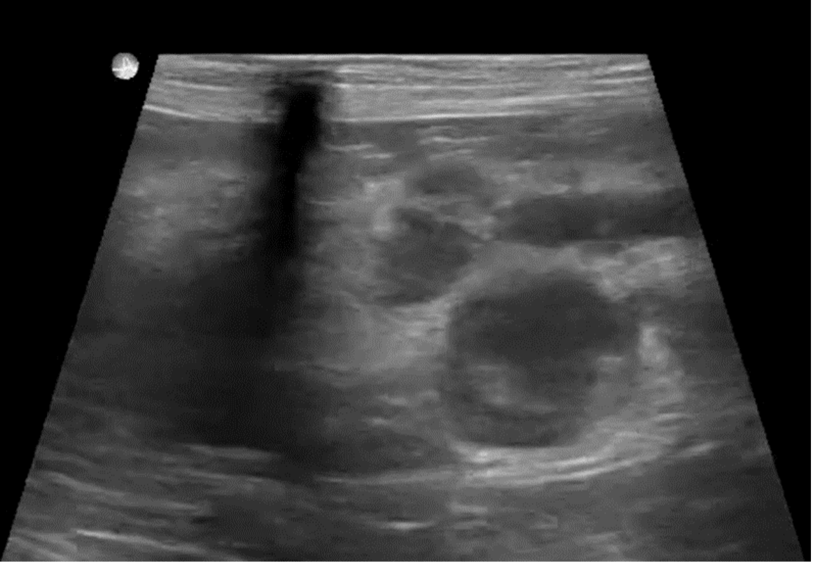 Ultrasound Characteristics of Canine Pancreatitis
